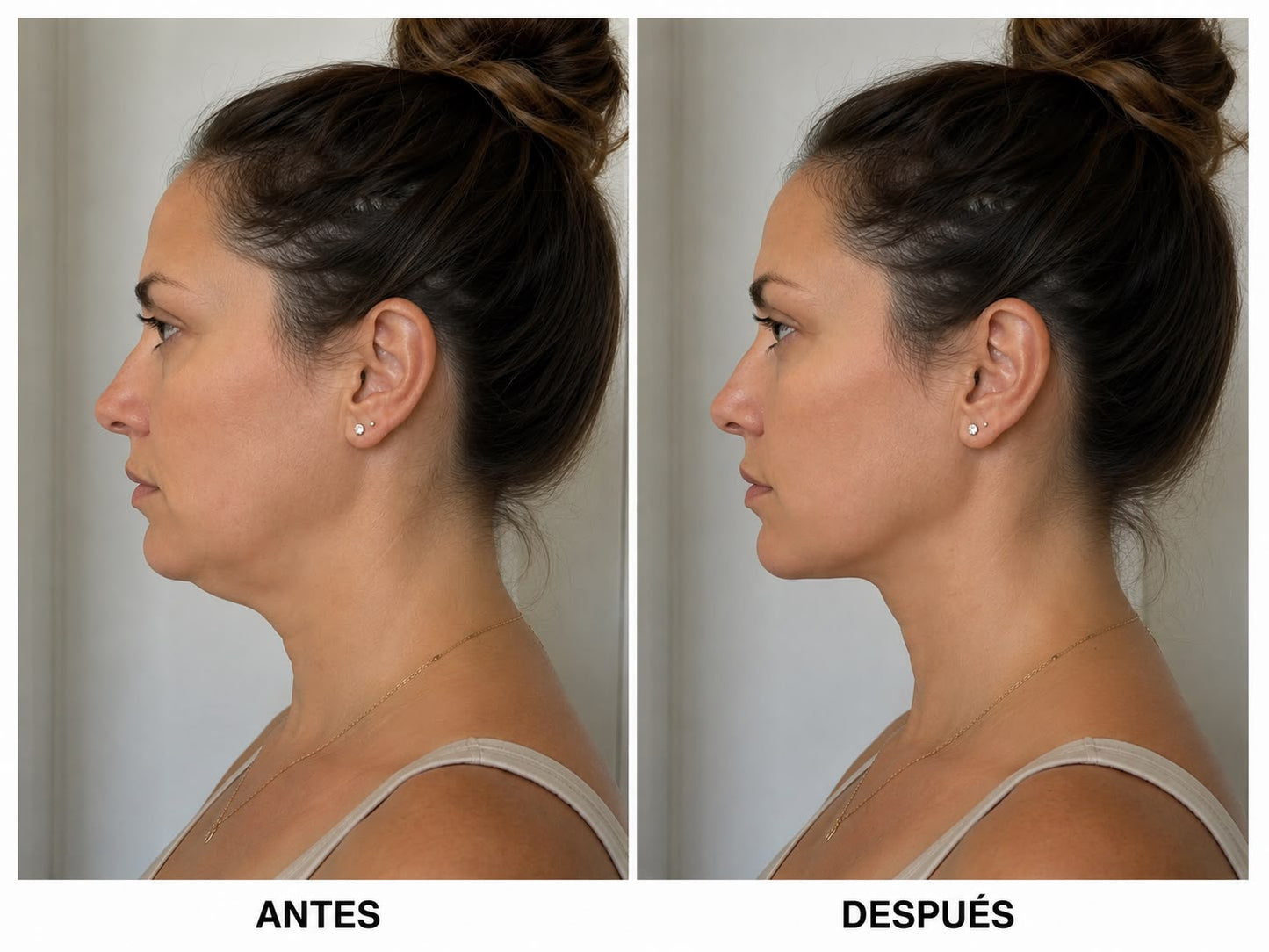 Masajeador Facial LED Reafirmante para Papada, Rostro y Cuello + Sérum de Regalo